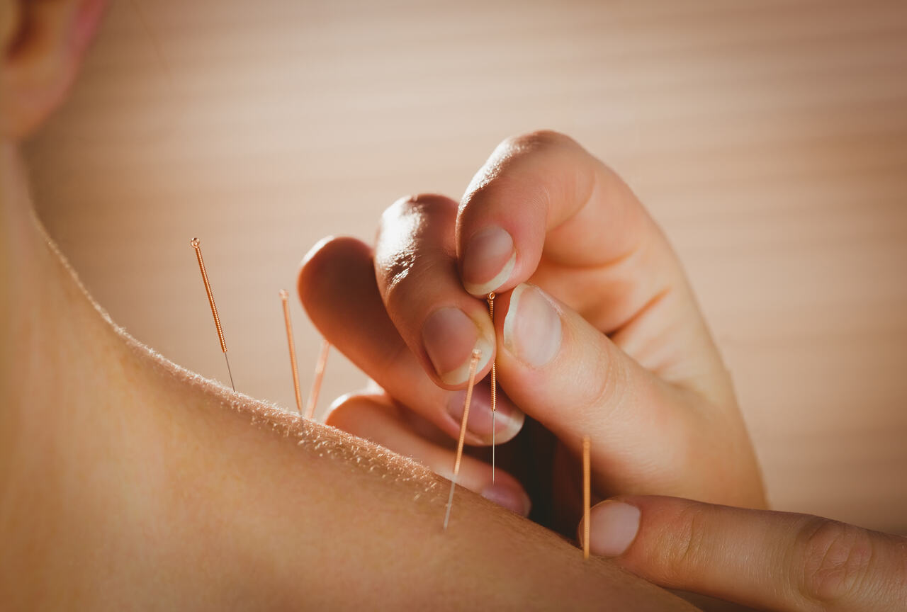 acupuncture for nerve pain mississauga port credit