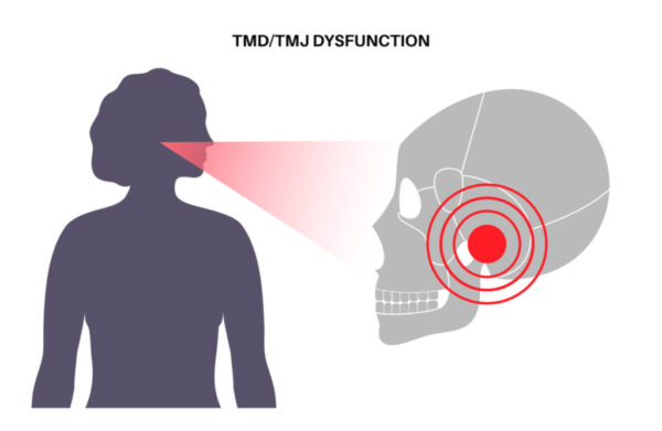TMJ Physiotherapy in Toronto